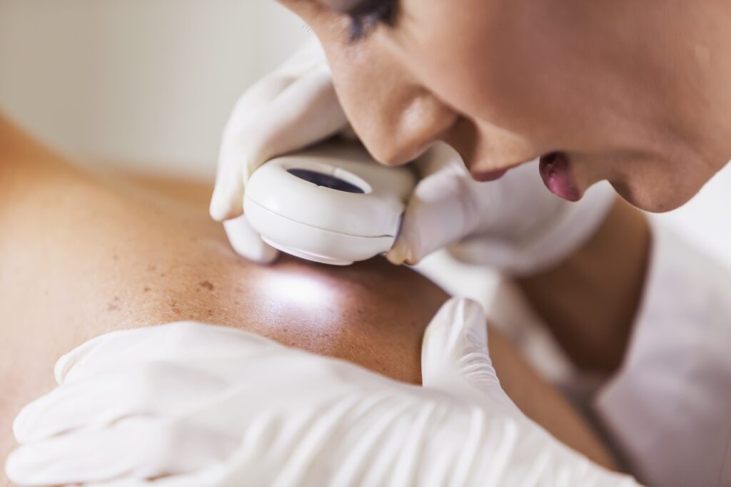 Dermatologist examining patient laser cicatrice acné paris