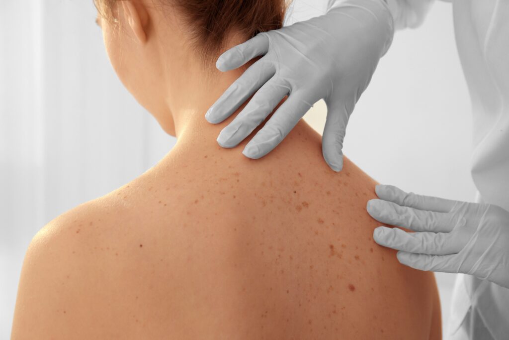 shutterstock_612916889_tarifs08 skin marceau - dermatologie et épilation laser