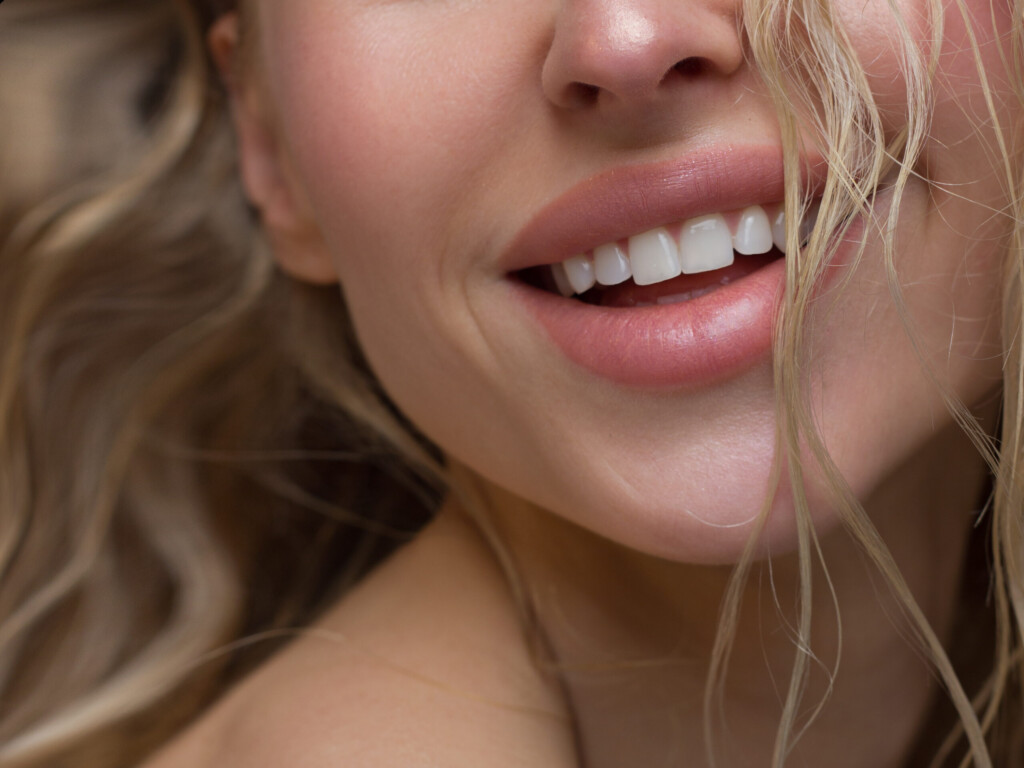 epilation laser menton
